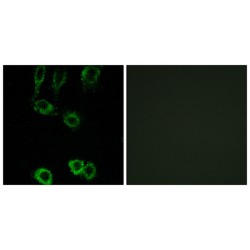 Calponin 2 (CNN2) Antibody