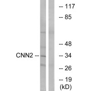 Western blot analysis of extracts from HUVEC cells, using CNN2 antibody.