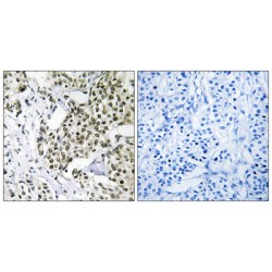 Cancer-Associated Gene 1 Protein (CAGE1) Antibody