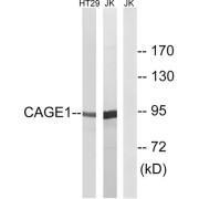 Western blot analysis of extracts from HT-29 cells and Jurkat cells, using CAGE1 antibody.