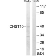 Western blot analysis of extracts from HuvEc cells, using CHST10 antibody.