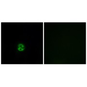 Immunofluorescence analysis of A549 cells, using CHST6 antibody.