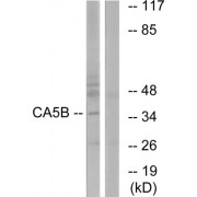 Western blot analysis of extracts from NIH/3T3 cells, using CA5B antibody.