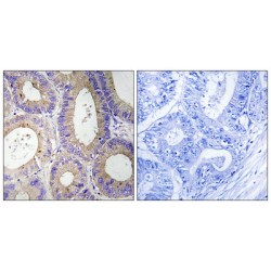 Carbonyl Reductase 3 (CBR3) Antibody