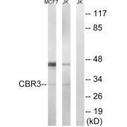 Western blot analysis of extracts from MCF7 cells and Jurkat cells, using CBR3 antibody.