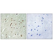 Immunohistochemistry analysis of paraffin-embedded human brain tissue using CNTROB antibody.