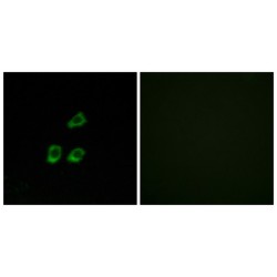 Chloride Voltage-Gated Channel 4 (CLCN4) Antibody