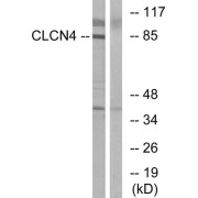 Western blot analysis of extracts from MCF-7 cells, using CLCN4 antibody.