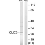 Western blot analysis of extracts from K562 cells, using CLIC3 antibody.