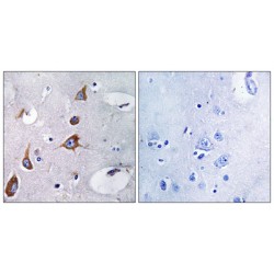 Chondroitin Sulfate Synthase 1 (CHSY1) Antibody