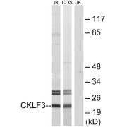 Western blot analysis of extracts from Jurkat cells and COS cells, using CKLF3 antibody.