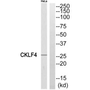 Western blot analysis of extracts from HeLa cells, using CKLF4 antibody.