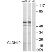 Western blot analysis of extracts fromHepG2 cells and Jurkat cells, using CLDN19 antibody.