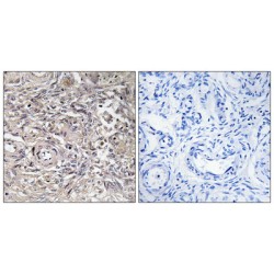 Claudin 6 (CLDN6) Antibody