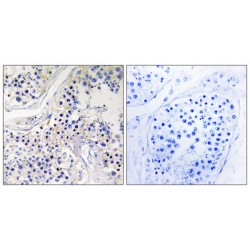 CLIP-Associating Protein 1 (CLASP1) Antibody