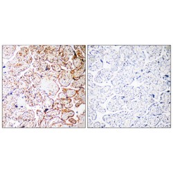 Coiled-Coil Domain Containing 102B (CCDC102B) Antibody