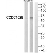 Western blot analysis of extracts from HuvEc cells and COLO cells, using CCDC102B antibody.