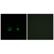 Immunofluorescence analysis of A549 cells, using CNTN4 antibody.