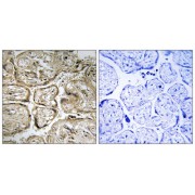 Immunohistochemistry analysis of paraffin-embedded human placenta tissue using CST9L antibody.