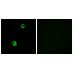 Cystatin SN (CST1) Antibody