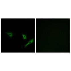 Cysteine Protease ATG4A (ATG4A) Antibody