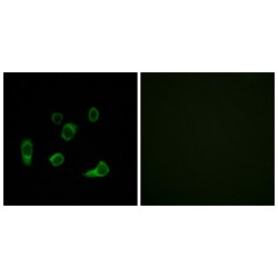 Autophagy Related 4C Cysteine Peptidase (ATG4C) Antibody