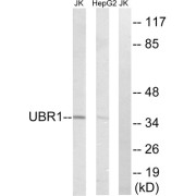 Western blot analysis of extracts from Jurkat cells and HepG2 cells, using UBR1 antibody.