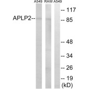 Western blot analysis of extracts from A549 cells and RAW264.7 cells, using APLP2 antibody.