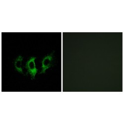 G-Elongation Factor, Mitochondrial 2 (GFM2) Antibody