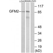 Western blot analysis of extracts from LOVO cells and RAW264.7cells, using GFM2 antibody.