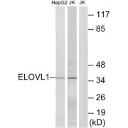 Western blot analysis of extracts from HepG2 cells and Jurkat cells, using ELOVL1 antibody.