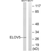 Western blot analysis of extracts from MCF-7 cells, using ELOVL5 antibody.