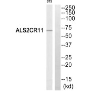 Western blot analysis of extracts from NIH/3T3 cells, using ALS2CR11 antibody.