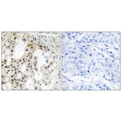 Eukaryotic Translation Initiation Factor 3 Subunit D (EIF3D) Antibody