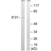 Western blot analysis of extracts from 3T3 cells, using EIF3D antibody.