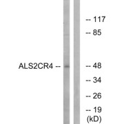 Western blot analysis of extracts from Jurkat cells, using ALS2CR4 antibody.