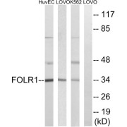 Western blot analysis of extracts from HUVEC cells, LOVO cells and K562 cells, using FOLR1 antibody.