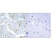 Immunohistochemistry analysis of paraffin-embedded human brain tissue using FMN2 antibody.