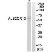 Western blot analysis of extracts from Jurkat cells, using ALS2CR13 antibody.