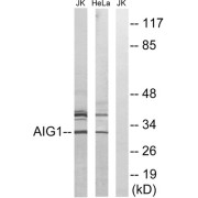 Western blot analysis of extracts from Jurkat cells and HeLa cells, using AIG1 antibody.