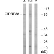 Western blot analysis of extracts from Jurkat cells and COS cells, using GIDRP88 antibody.