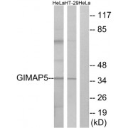 Western blot analysis of extracts from HeLa cells and HT-29 cells, using GIMAP5 antibody.