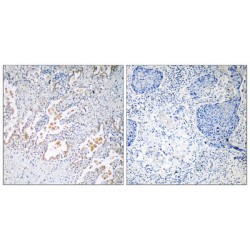 Guanine Nucleotide Binding Protein Subunit Beta 5 (GNB5) Antibody