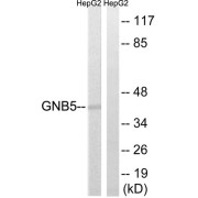 Western blot analysis of extracts from HepG2 cells, using GNB5 antibody.