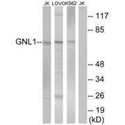 Western blot analysis of extracts from Jurkat cells, LOVO cells and K562 cells, using GNL1 antibody.