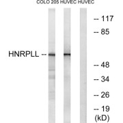 Western blot analysis of extracts from COLO cells and HUVEC cells, using HNRPLL antibody.