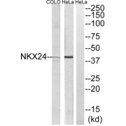 Western blot analysis of extracts from HeLa and COLO205 cells, using NKX24 antibody.