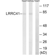 Western blot analysis of extracts from rat kidney/rat heart cells, using LRRC41 antibody.