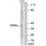 Western blot analysis of extracts of LOVO cells, using GNAL antibody. The lane on the right is blocked with the peptide.