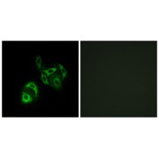 Immunofluorescence analysis of A549 cells, using SLC27A4 antibody.